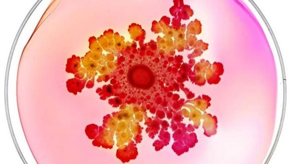 Ketika Koloni Bakteri di Atas Cawan Petri Diubah Jadi Karya Seni Indah