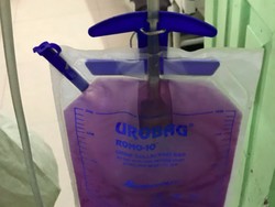 Dirawat karena Infeksi, Pipis Berubah Jadi Ungu