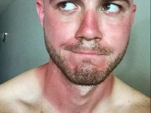 Foto-foto Ini Buktikan Matahari Bisa Jadi Ahli Tato yang Keren Tapi Seram (2)