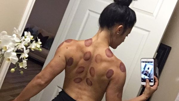 Foto: Jessica Arevalo, Bodybuilder Cantik yang Doyan Bekam