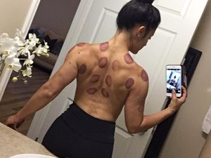 Foto: Jessica Arevalo, Bodybuilder Cantik yang Doyan Bekam