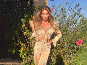 Ini Penampilan Wanita yang Oplas Tiap Tahun, Hidung & Payudara Palsu