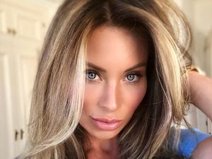 Tak Pernah Puas dengan Penampilan, Wanita Ini Operasi Plastik Tiap Tahun