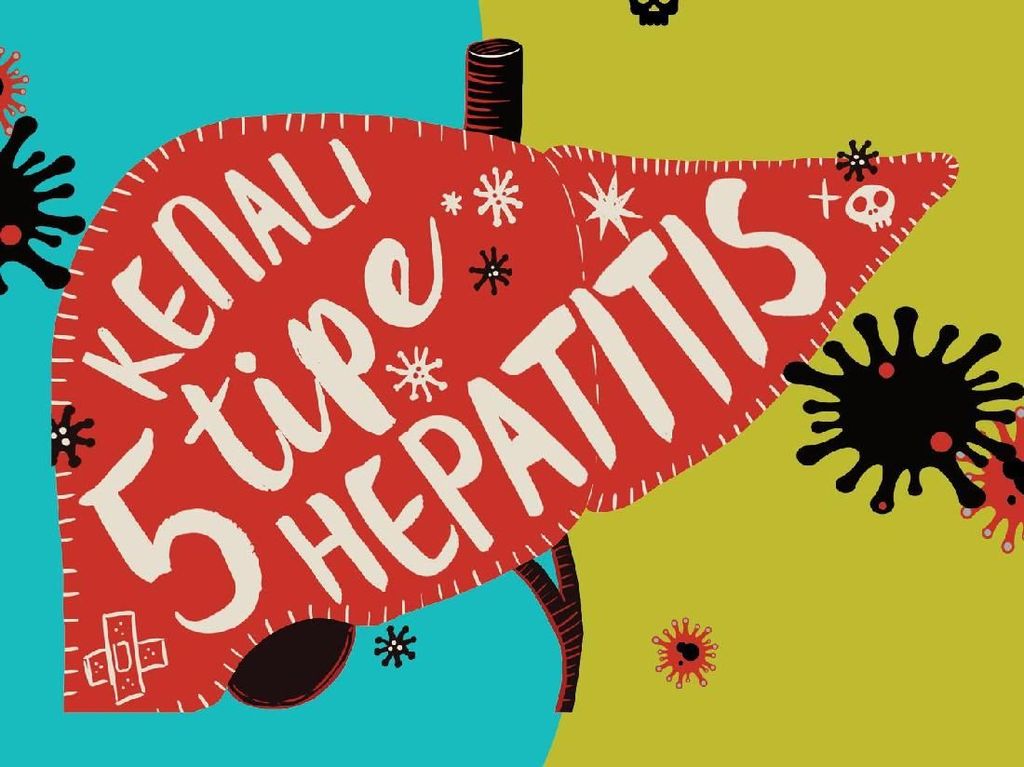 Infografis: Kenali 5 Tipe Hepatitis, Silent Killer di Sekitar Kita Infografis: Kenali 5 Tipe Hepatitis, Silent Killer di Sekitar Kita