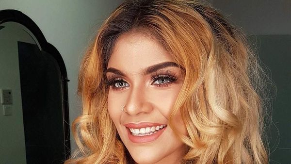 Intip Pesona Mantan Ratu Kecantikan yang Pernah Di-bully karena BB 104 Kg