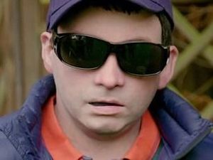 Alergi Matahari, Pria Ini Pakai Topeng Replika Wajahnya Sendiri