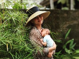 Mengenal Kondisi Kepala Peyang yang Dialami Anak Chrissy Teigen