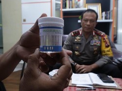 Pasca Kasus AKBP Hartono, Pejabat Utama Polda Kalbar Dites Narkoba