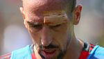 Foto: Perban di Jidat Ribery Usai Tabrak Tiang Gawang Saat Latihan