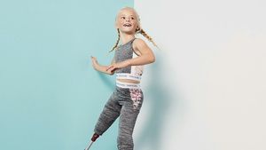 Ini Daisy-May, Model Cilik Tanpa Dua Kaki yang Curi Perhatian Dunia