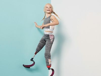 Ini Daisy-May, Model Cilik Tanpa Dua Kaki yang Curi Perhatian Dunia
