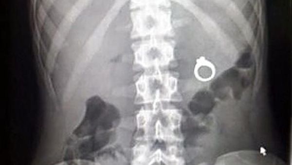 Kumpul Potret Aneh Hasil SInar X Bikin Geleng-geleng