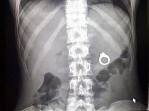 Kumpul Potret Aneh Hasil SInar X Bikin Geleng-geleng