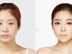 Hii Serem! Operasi Berbahaya Ini Dilakukan Artis Korea Supaya Jadi Cantik