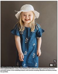 Inspiratif! Bocah dengan Down Syndrome Ini Sukses Jadi Model