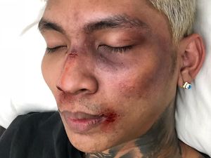 Warganet Anggap Aksi Prank Young Lex yang Ngaku Dipukuli Fitnah