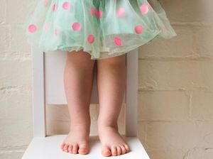 Cara Mencegah dan Menangani Kaki Anak Kapalan Cara Mencegah dan Menangani Kaki Anak Kapalan