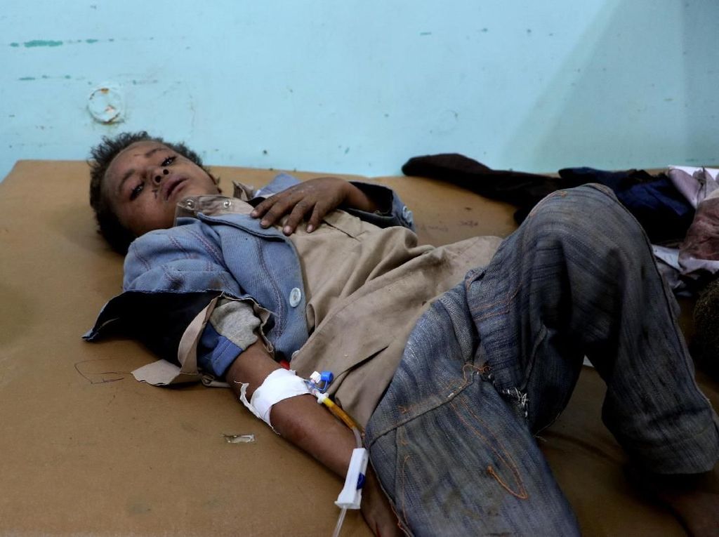 Serangan di Yaman Tewaskan 29 Anak, PBB dan AS Desak Penyelidikan Serangan di Yaman Tewaskan 29 Anak, PBB dan AS Desak Penyelidikan