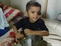 Kanker Mata, Bocah Ganteng Asal Pangandaran Ini Butuh Bantuan