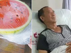 Waduh! Karena Makan Semangka dari Kulkas, Pria Ini Kena Obstruksi Usus