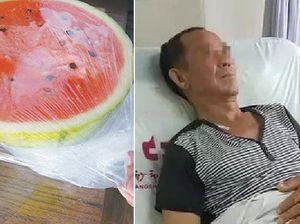 Waduh! Karena Makan Semangka dari Kulkas, Pria Ini Kena Obstruksi Usus Waduh! Karena Makan Semangka dari Kulkas, Pria Ini Kena Obstruksi Usus