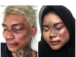 Viral Tutorial Makeup Muka Babak Belur Young Lex, Seperti Ini Hasilnya