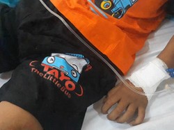 Bocah di Aceh Lumpuh Usai Vaksin MR, Ini Kata Kemenkes