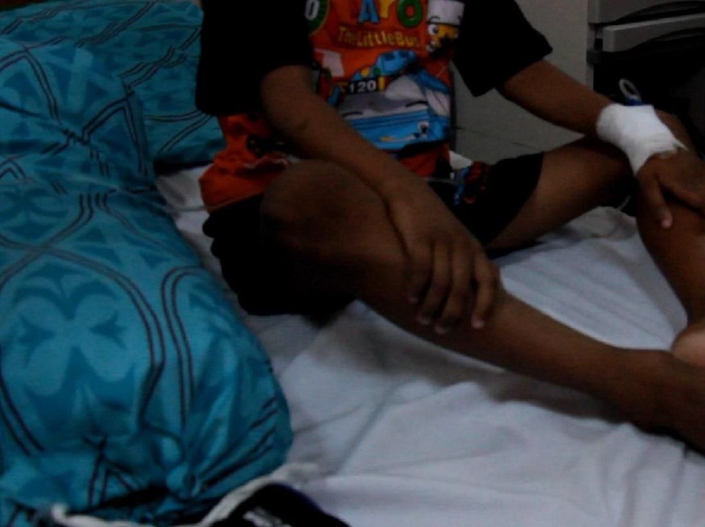Bocah di Aceh Lumpuh Usai Imunisasi MR, Dokter: Bukan Efek Vaksin