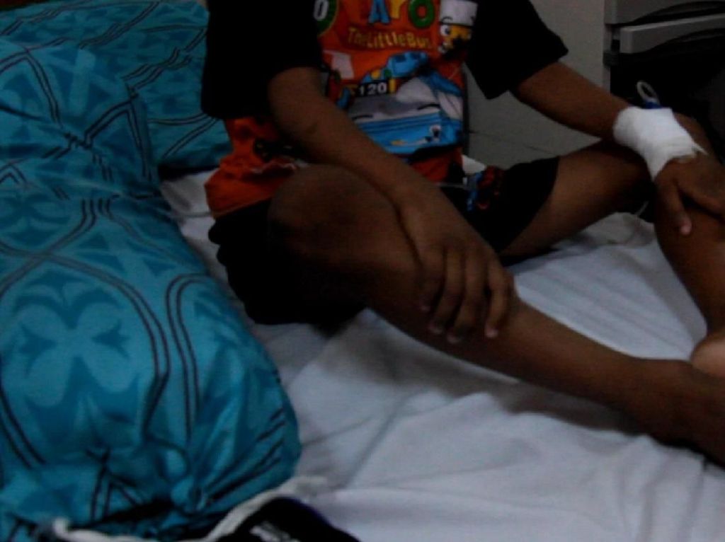 Bocah di Aceh Lumpuh Usai Imunisasi MR, Dokter: Bukan Efek Vaksin Bocah di Aceh Lumpuh Usai Imunisasi MR, Dokter: Bukan Efek Vaksin