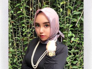 Filler Wajah, Salmafina Sunan Akui Bukan untuk Caper ke Laki-laki