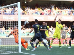 Duel dengan Ronaldo, Kiper Ini Alami Retak Tulang Hidung