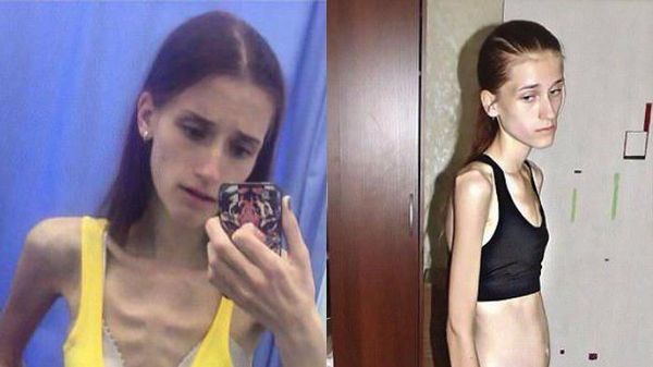 Dulu Kurusnya Kebangetan, Transformasi Penampilan Wanita Ini Bikin Melongo