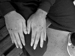 Cerita Dinsos Terima Pria Keterbelakangan Mental yang Babak Belur