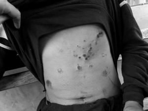 Aniaya Pria Keterbelakangan Mental, 6 Orang EO Flona Jadi Tersangka