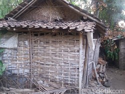 Potret Gizi Buruk di Bondowoso, Ini Tindakan yang Diambil Dinkes