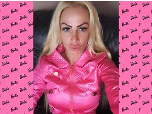 Wanita Barbie Ini Berkali-kali Oplas Tapi Belum Puas, Begini Penampilannya