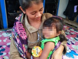 Kasihan, Berat Badan Bocah Berusia 3 Tahun ini Hanya 8 Kg