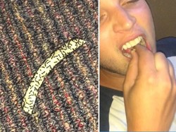 Demi Taruhan, Pria Ini Rela Makan Kentang Goreng dengan Semut Hidup