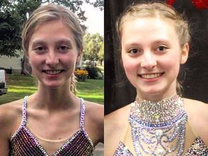 Idap Anoreksia, Berat Badan Wanita Ini Sempat Hanya 33 Kg