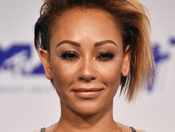 Pro Kontra Tindakan Vaginal Scraping yang Dilakukan Mel B