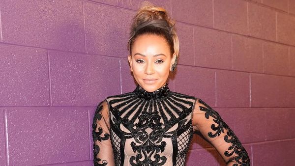 Lakukan Facelift, Ini Perubahan Wajah Mel B yang Ngaku Kecanduan Seks