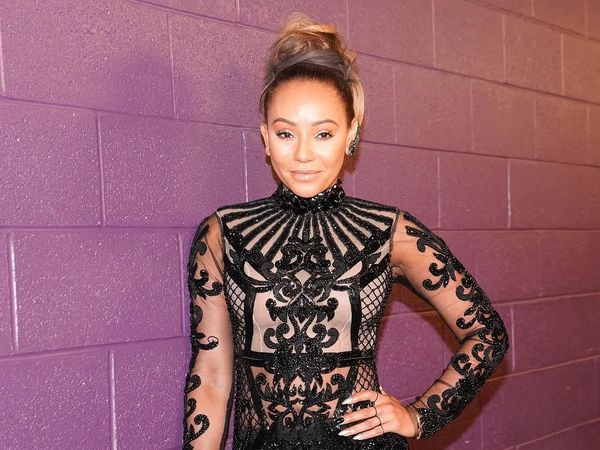 Lakukan Facelift, Ini Perubahan Wajah Mel B yang Ngaku Kecanduan Seks