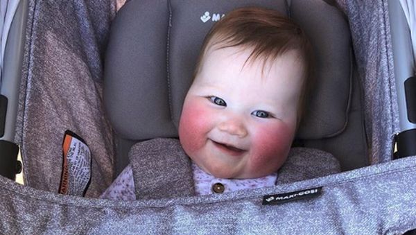 Foto: Bayi Pipi Tomat yang Super Menggemaskan