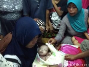 Kembar Siam Perut dan Dada Asal Probolinggo Berpulang