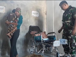 Cerita Pilu Yudis, Bocah Kurus dan Lumpuh Karena Kelainan asal Magetan