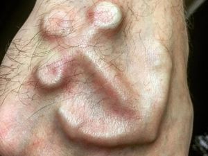 Keren atau Geli? Potret Tato Implan yang Menyembul di Kulit