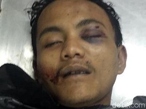 Kata Warga Soal Ami, Begal Bandung yang Tewas Didor Polisi