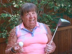 Kisah Wanita yang Dipenuhi 1.000 Tumor di Tubuhnya