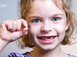 Penyebab dan Cara Mencegah Gigi Patah pada Anak