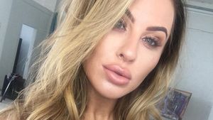 Potret Selebgram yang Bibirnya Kempes Setelah Hapus Filler ala Kylie Jenner